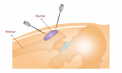 Regenerative Medicine