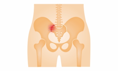 Treatment-for-SI-joint-dysfunction-which-is-causing-low-back-pain-1